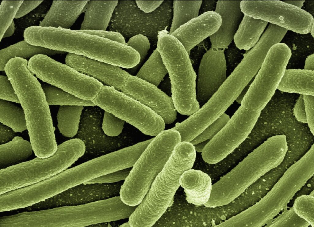 koli-bacteria-123081_1280-8ba88482